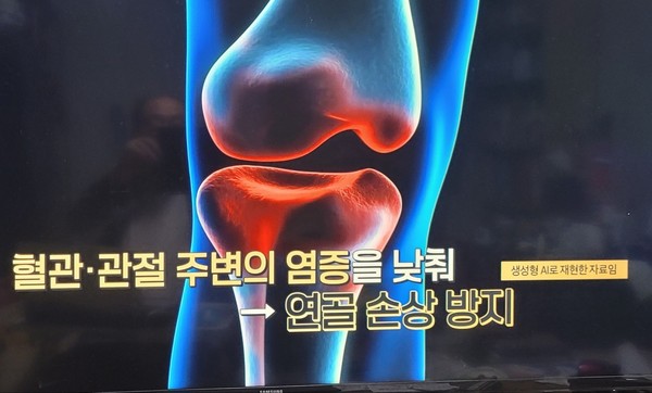 [창간기획 1]시니어 88–  골다공증, 근감소증 1