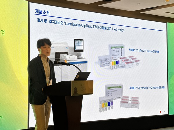 대웅바이오, 혈액 기반 알츠하이머병 진단 기술 국내 도입