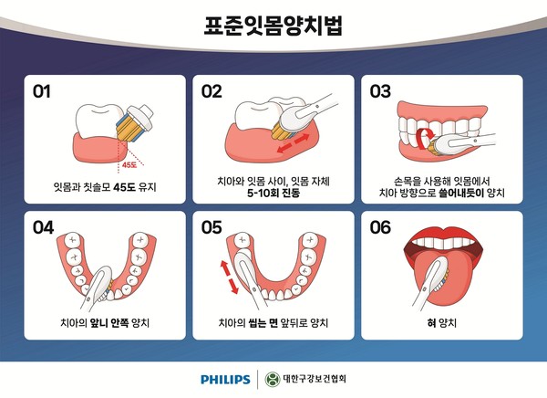 ‘치은염 및 치주질환(잇몸병)’ 외래 방문 환자 약 1,997만 명