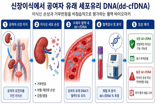 신장이식 후 불필요한 조직검사 줄인다...‘거부반응 정밀 선별’